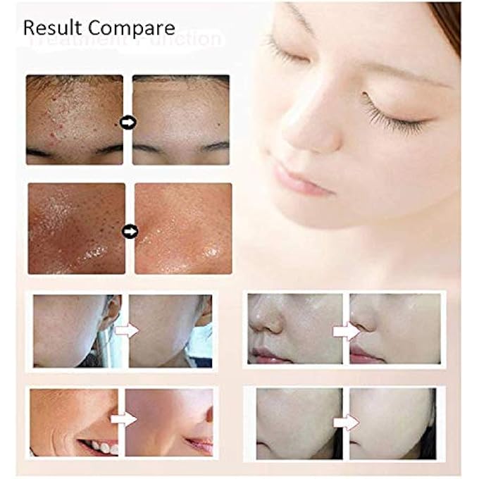 STRBOXONG ANTI-AGING SKIN REJUVENATION FACE & NECK CARE TREATMENT - Image 4